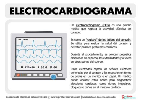 Qué es un Electrocardiograma