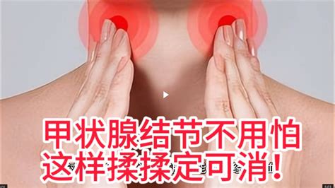 甲状腺结节不用怕，这样揉揉定可消。 Youtube