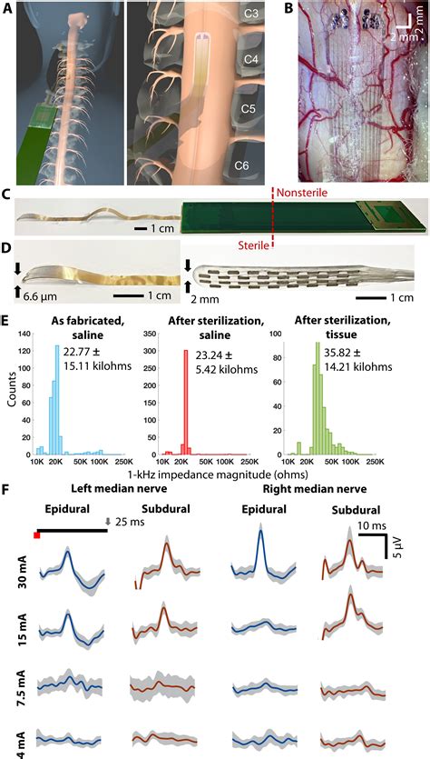 Constructing 2D maps of human spinal cord activity and isolating the