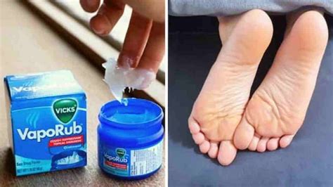 Il A Mis Vicks Vaporub Sur Ses Pieds Pour Une Raison Astucieuse