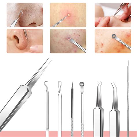 How To Use An Extraction Tool For Blackheads at John Pavon blog