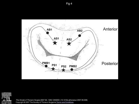 Mitral Valve Basal Chordae Comparative Anatomy And Terminology Ppt