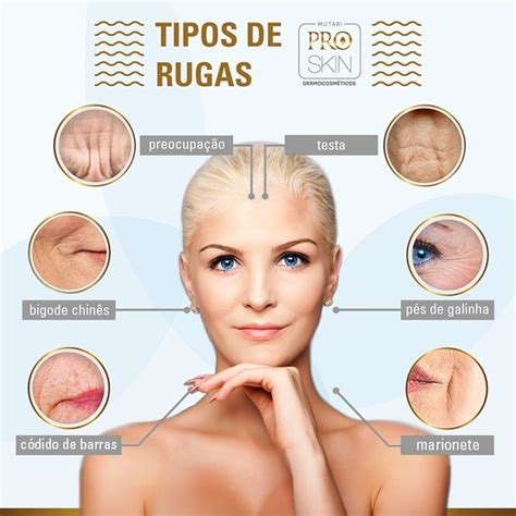 Rugas Entenda As Diferen As E Como Tratar Mutari