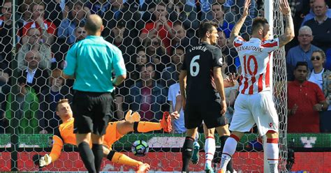 Mignolet Reveals Jurgen Klopp S Post Stoke Joke TEAMtalk