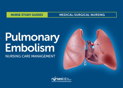 Pulmonary Embolism Nursing Care And Management Study Guide