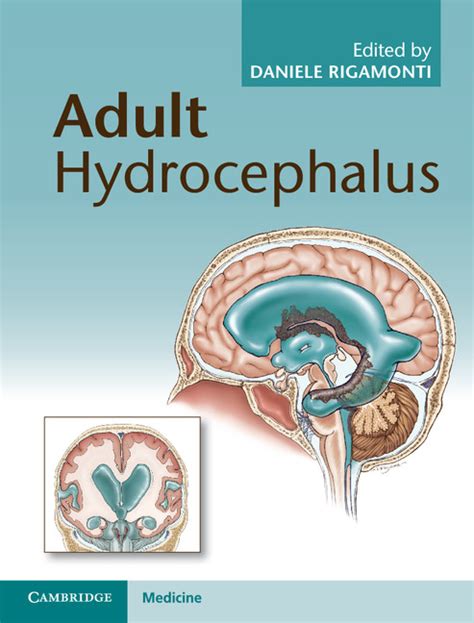 Hydrocephalus Shunt Procedures Chapter 16 Adult Hydrocephalus