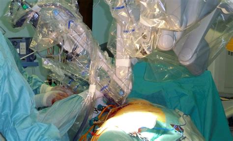 Robotic Resection Of Left Atrial Myxoma Intechopen