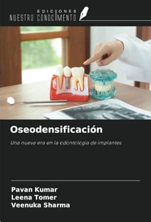 Oseodensificación Una nueva era en la odontología de implantes