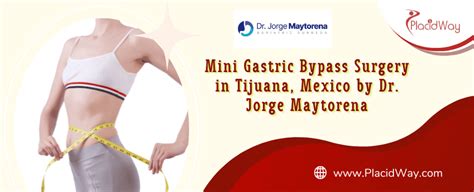 Mini Gastric Bypass In Tijuana Mexico