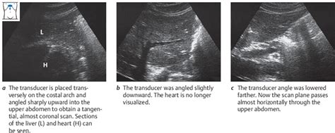 Liver Radiology Key