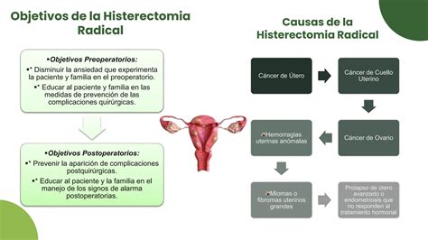 Histerectomia Radical Pptx