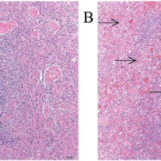 Representative Histological Photomicrographs Of The Spleen Of