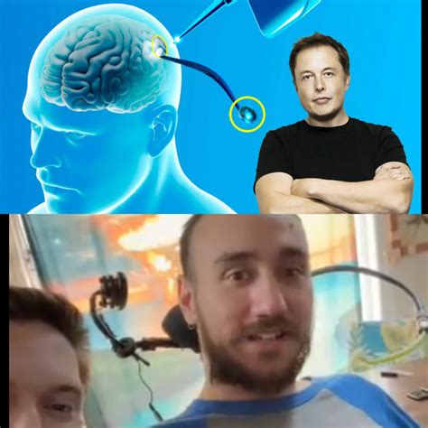 Neuralink Le Premier Humain Avec La Puce C R Brale D Elon Musk