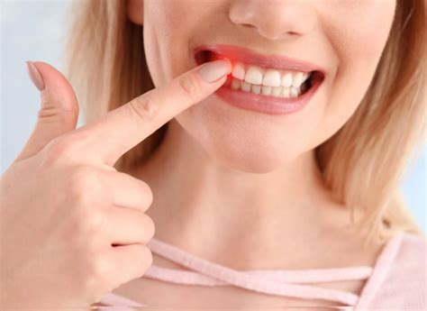 Receding Gums Causes Symptoms and Treatment Options Nova DiŞ