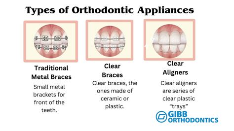 Ppt The Best Orthodontic Treatment For Adults By Gibb Orthodontics