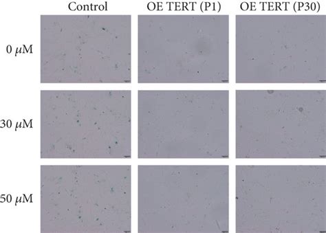 Verteporfin led to increase senescence cell rate. The rate of cell ... 