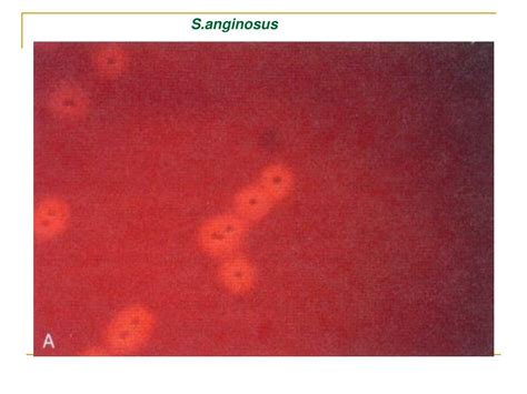 PPT - STREPTOCOCCUS PowerPoint Presentation, free download - ID:5515035