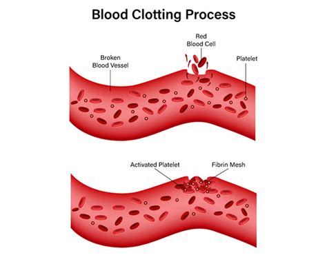 Blood Clotting Process Science Diagram Illustration Behance
