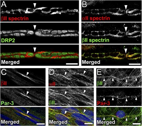 Schwann Cell Spectrins Modulate Peripheral Nerve Myelination PNAS