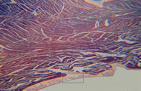 HLS [ Muscle Tissue, Purkinje cells] LOW MAG