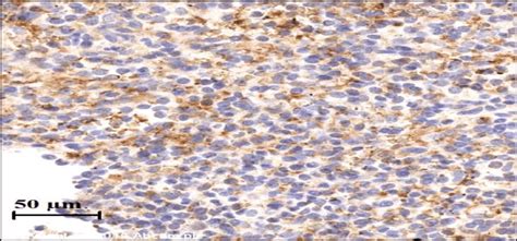 The instruction slide for immunohistochemistry for IL-6 positive ...