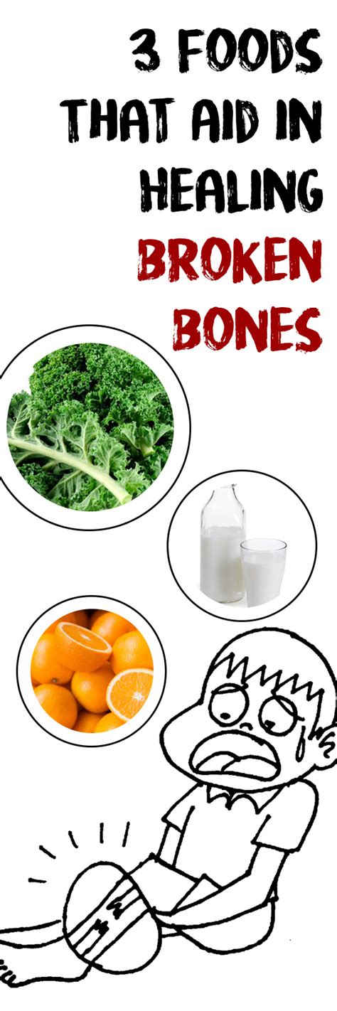 3 Foods That Aid in Healing Broken Bones