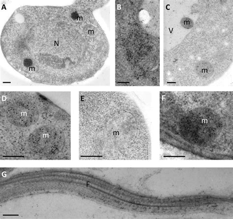 Top 95 Pictures Label The Transmission Electron Micrograph Of The Cell