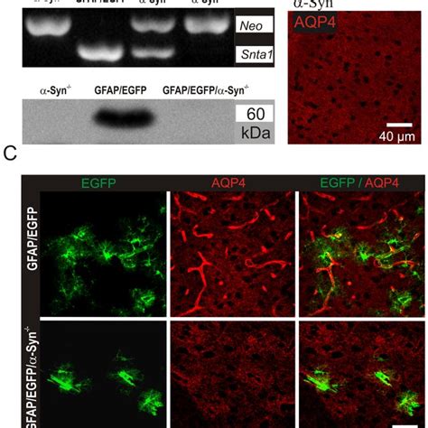 Gene Expression Profile Of Cortical Astrocytes From GFAP EGFP And