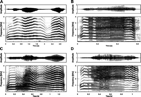 Amplitude By Time Waveforms And The Corresponding Narrowband Hz