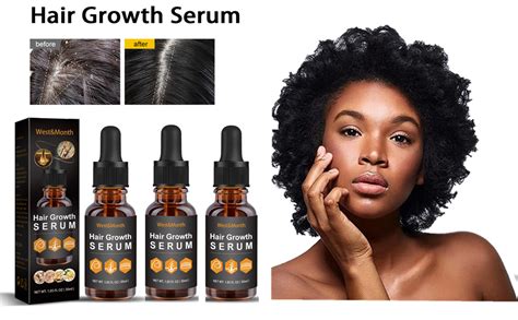 Amazon Allurium Hair Growth Serum For Black Women Allurium