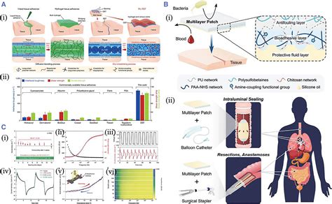 Tissue Adhesives For Wound Closure Kong Smart Medicine