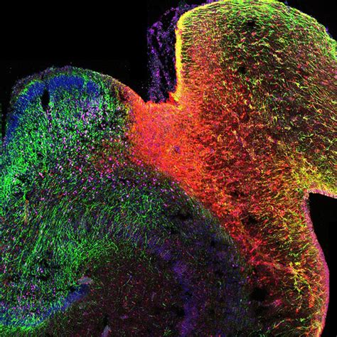 Cientistas criam o primeiro mapa de modificação de DNA no cérebro