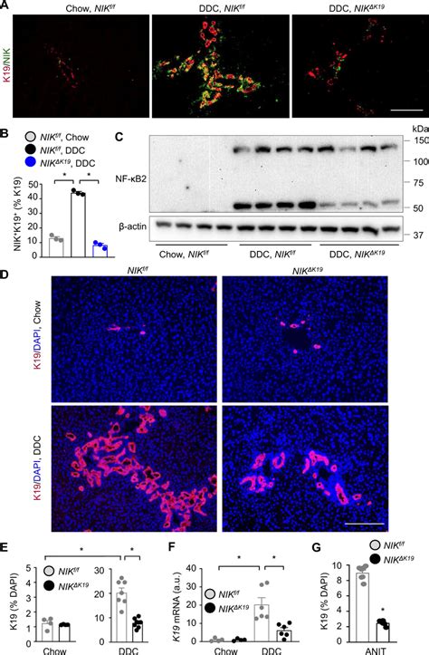 Ablation Of Biliary Nik Attenuates Ddc Induced Ductular Download Scientific Diagram