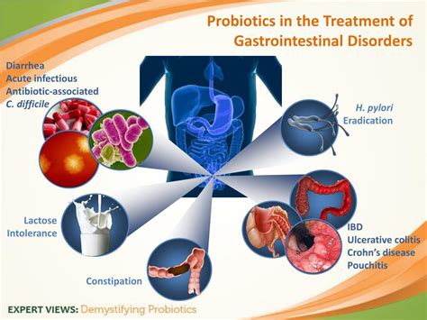 Management Of Antibiotic Associated Diarrhea