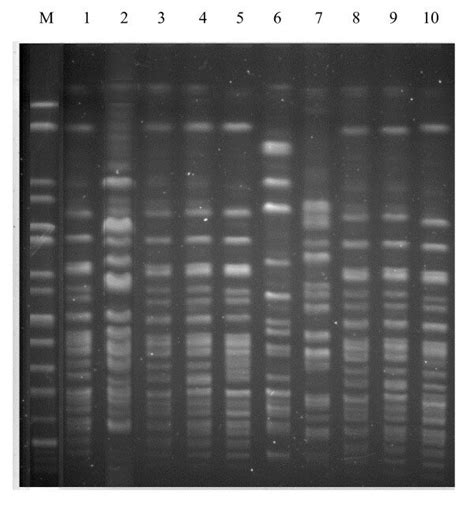 PFGE Of XbaI Digested Genomic DNAs From S Boydii Isolates Lane M Is