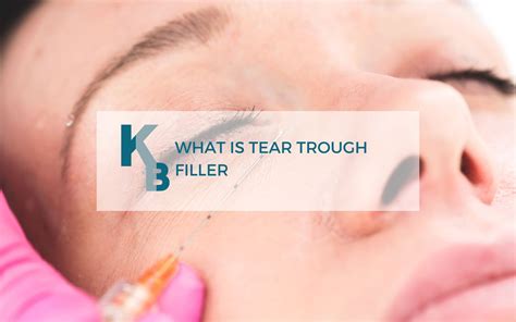 What Is Tear Trough Filler Essence Medical Cosmetic Clinic