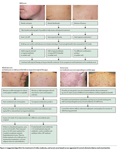 PDF Acne Vulgaris Semantic Scholar