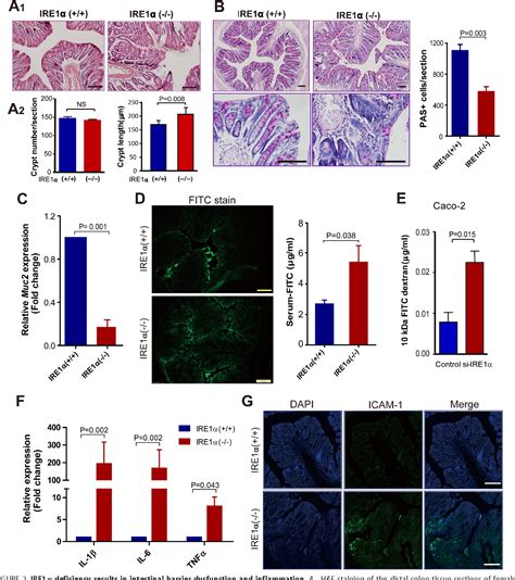 Figure 2 from The Endoplasmic Reticulum Stress Sensor IRE1α in