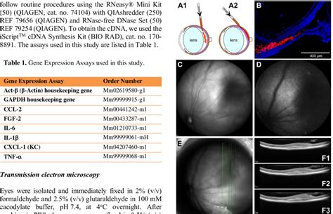 Principle Of Subretinal Injection A Comparison Of Intravitreal A1