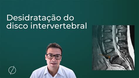 Desidratação do disco intervertebral Especialista explica YouTube