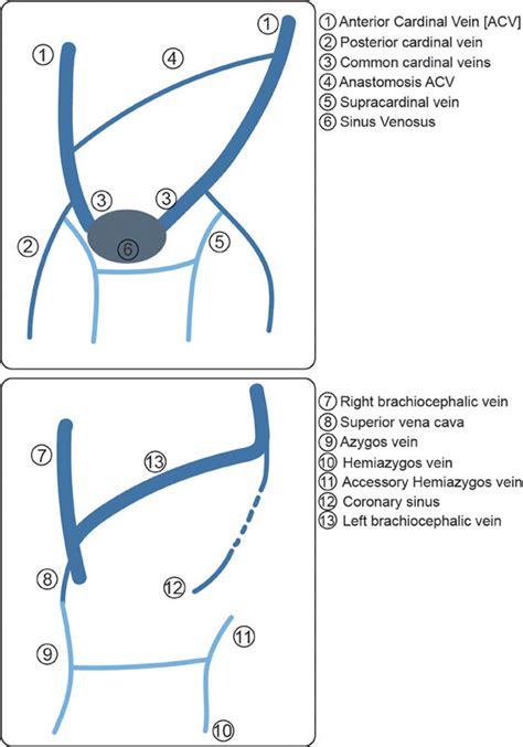 Embryology Of The Superior Vena Cava And Brachiocephalic Vein The Main