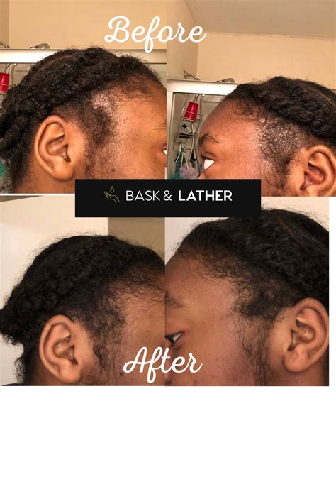 Rosemary Oil For Hair Growth Before And After Bask And Lather Co