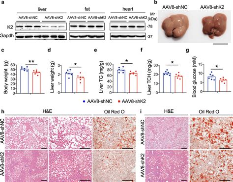 Kindlin Knockdown Attenuates Hepatic Steatosis In Hfd And Ob Ob