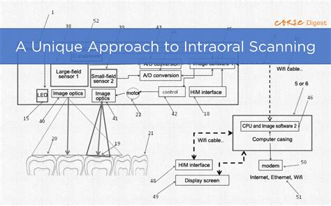 A Unique Approach To Intraoral Scanning Cerec Digest