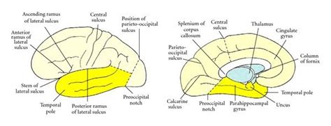 Boundaries Of The Temporal Lobe And Positions Of Major Sulci And Gyri