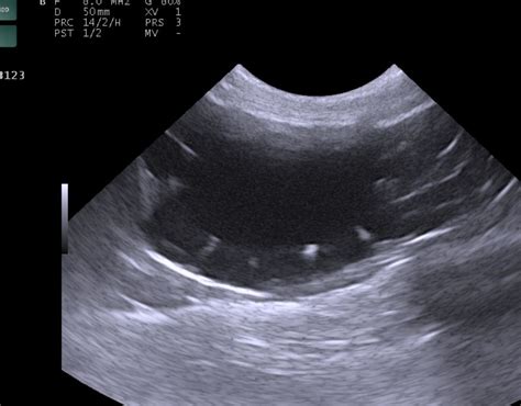 Dvm Ahmed Hammam On Linkedin Felineultrasoundhydronephrosis