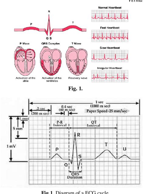 Figure From Ecg Compression Using Discrete Wavelet Transform With