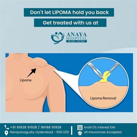 Lipoma Treatment In Hyderabad Anaya Hospitals Anaya Hospitals Medium