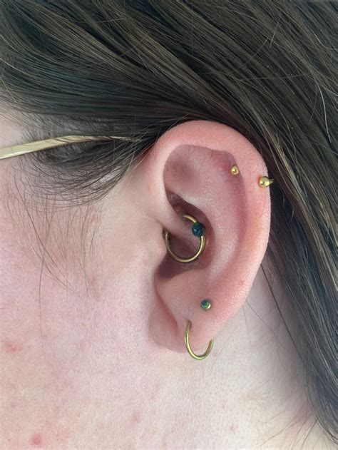 Daith Piercing Bumps Get Better Hang In There Heres My Healing Over