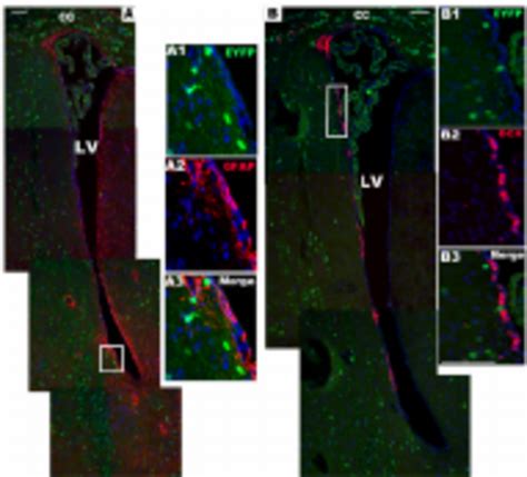 Gfap Nscs And Dcx Neuroblasts In Svz Are Not Labeled With Eyfp A